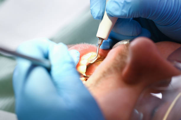 Best Dentist for Tooth Abscess  in Sauk Rapids, MN
